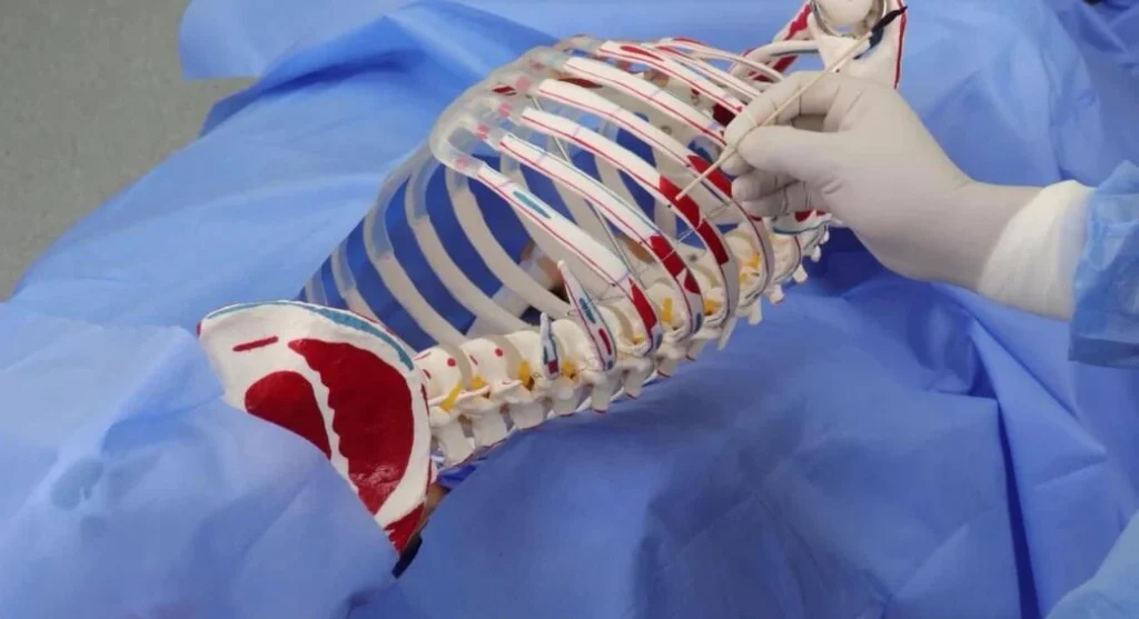 بازسازی دنده