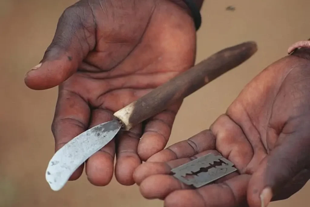 ختنه در آفریقای جنوبی