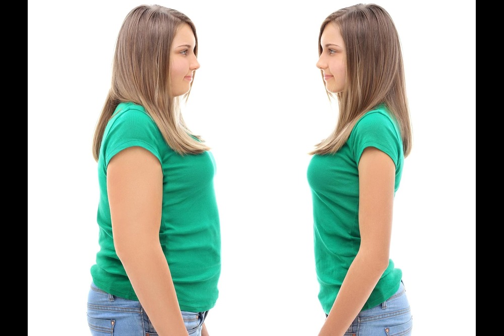 چه چیزی باعث لاغری سریع می‌شود؟