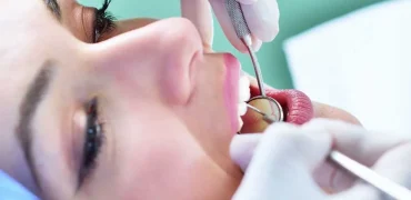 آیا استفاده از خدمات دندانپزشکی باعث باطل شدن روزه می‌شود؟