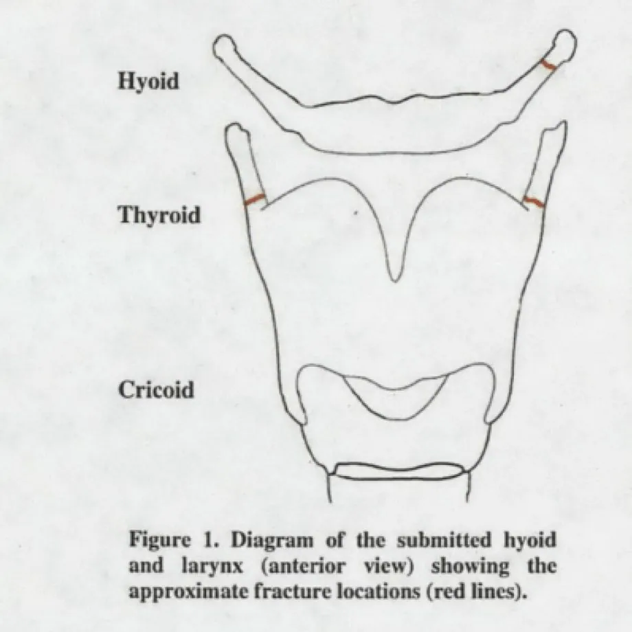 کالبدشکافی اپستین