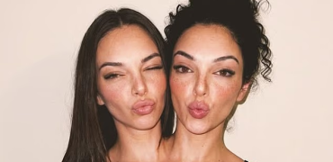 جنجال دوقلوهای به‌هم‌چسبیده مشهور در اینستاگرام که فیک از آب درآمدند!