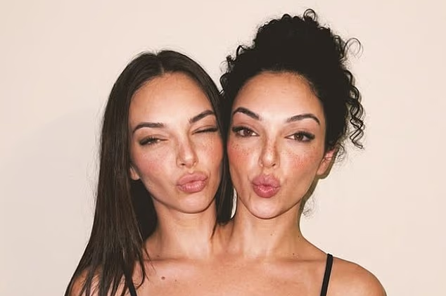 جنجال دوقلوهای به‌هم‌چسبیده مشهور در اینستاگرام که فیک از آب درآمدند!