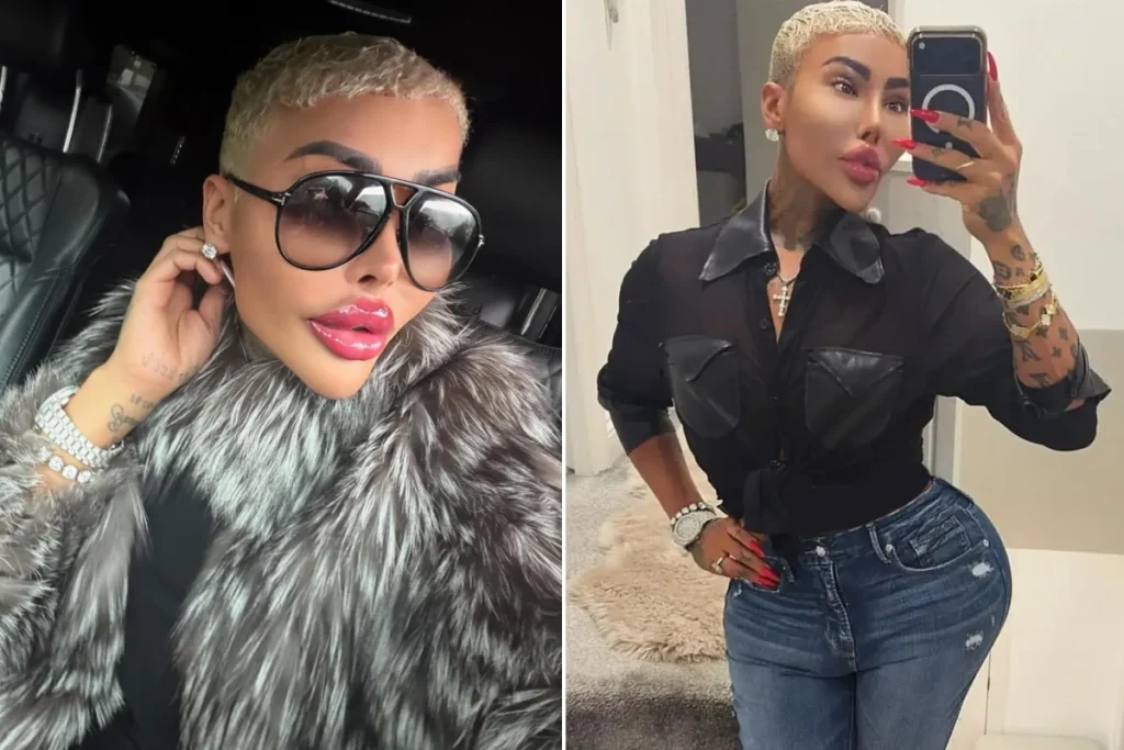 مرگ مشکوک زن شیفته کیم کارداشیان ملقب به «سلطان لب» پس از لیفت باسن برزیلی