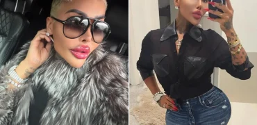 مرگ مشکوک زن شیفته کیم کارداشیان ملقب به «سلطان لب» پس از لیفت باسن برزیلی