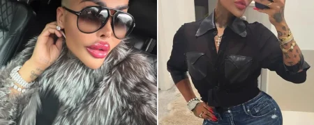 مرگ مشکوک زن شیفته کیم کارداشیان ملقب به «سلطان لب» پس از لیفت باسن برزیلی