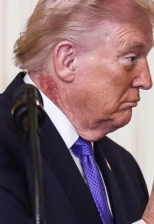 ترامپ