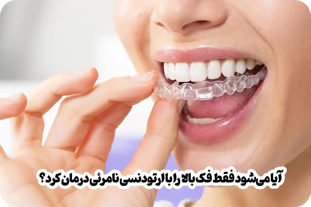 آیا می‌شود فقط فک بالا را با ارتودنسی نامرئی درمان کرد؟