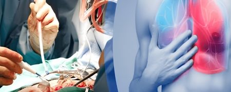 جراحی قفسه سینه یا توراکس چیست و در چه شرایطی انجام می‌شود؟ + علائم
