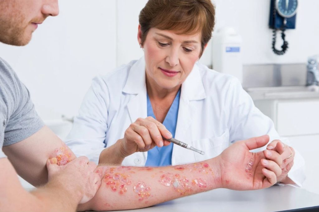 پمفیگوس