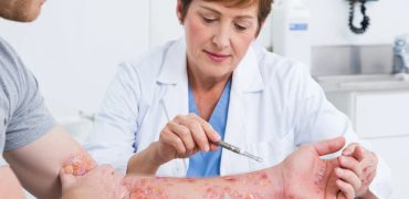 بیماری پمفیگوس؛ از علائم و انواع مختلف گرفته تا علت و روش تشخیص