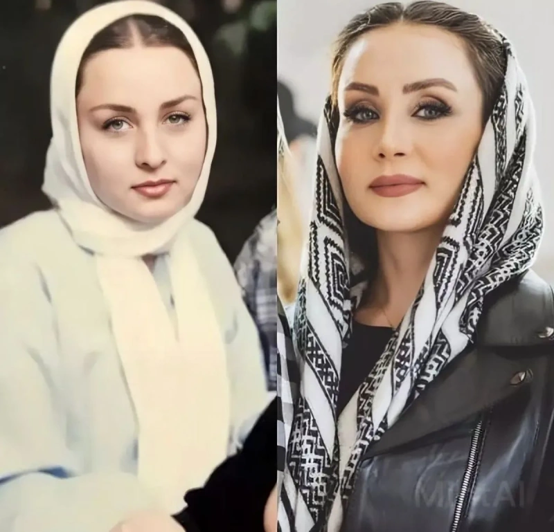 عمل زیبایی حدیث فولادوند